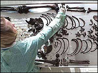 Human bones on morgue table 